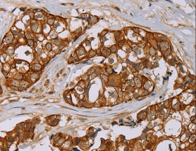 Polyclonal Rabbit anti-Human MTUS1 Antibody (IHC)