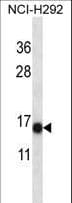 S100A7 / Psoriasin Antibody (aa2-31)