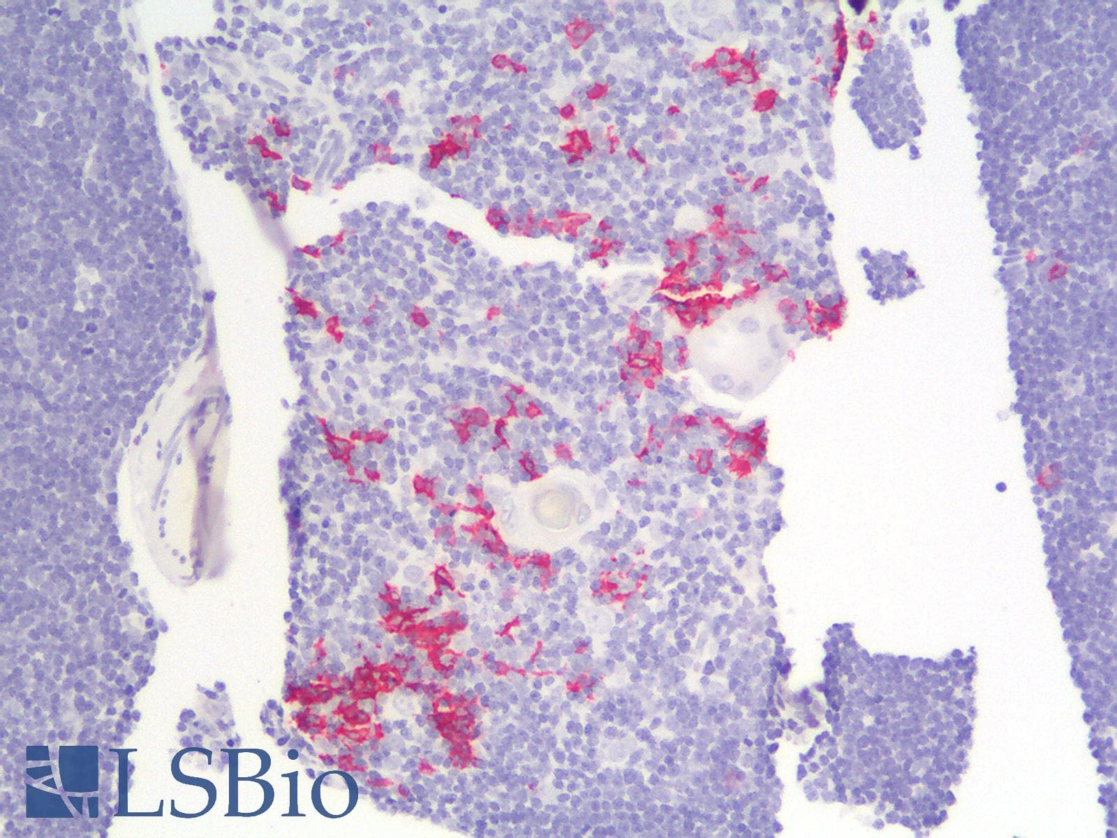 PathPlus™ CD20 Antibody (clone IGEL/1497R)