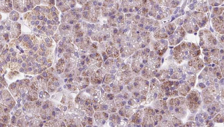 Polyclonal Rabbit anti-Human DYNC2LI1 / D2LIC Antibody (IHC, WB)