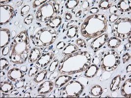 TS / Thromboxane Synthase Antibody (clone OTI1C3)