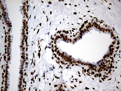 HNRNPH1 / hnRNP H Antibody (clone OTI4F10)