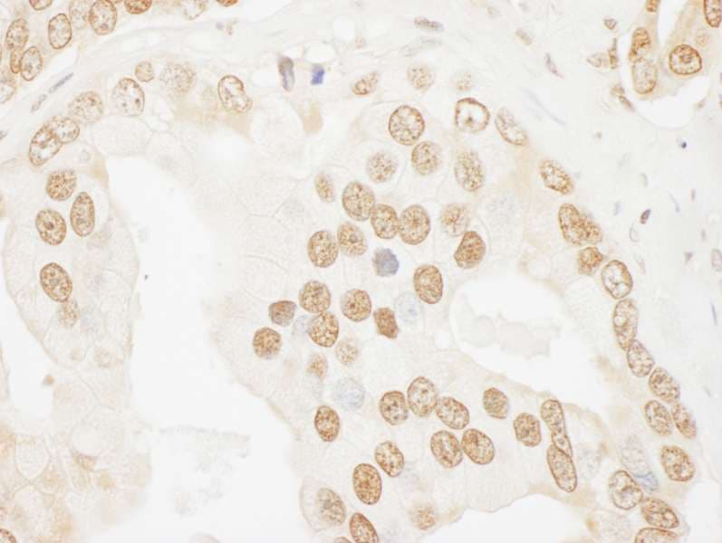 Polyclonal Rabbit anti-Human POP1 Antibody (aa925-975, IHC)