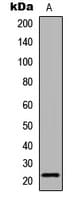 Polyclonal Rabbit anti-Human CLDN6 / Claudin 6 Antibody (aa103-137, IHC, IF, WB)