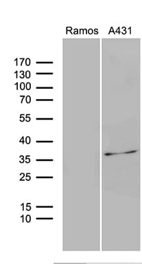 DAPP1 / BAM32 Antibody (clone OTI1C10)