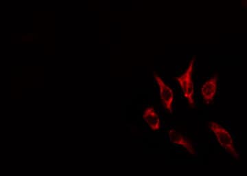 ACKR4 / CCRL1 / CCR11 Antibody