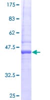 Human RTKN2 Protein (Recombinant GST)