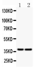 CD79A / CD79 Alpha Antibody (aa121-226)