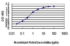 IHC-plus™ Monoclonal Mouse anti-Human EPSTI1 Antibody (clone 2A8, IHC, WB)