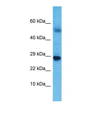 NKX6-3 Antibody (aa180-229)