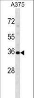 USP12 Antibody (aa222-251)