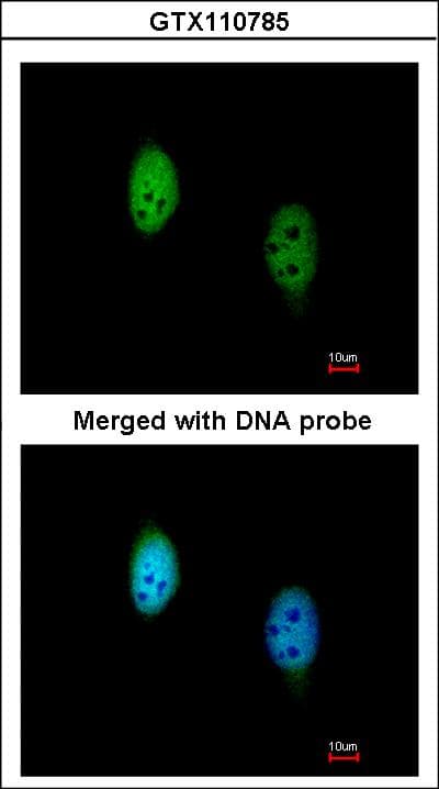 Polyclonal Rabbit anti-Human TBL1XR1 / TBLR1 Antibody (aa210-514, IHC, WB)