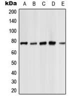 Polyclonal Rabbit anti-Human PRKCZ / PKC-Zeta Antibody (C-Terminus, IHC, IF, WB)