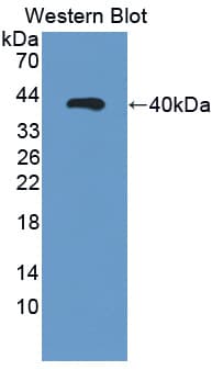 RLBP1 / CRALBP Antibody (APC)