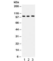 Polyclonal Rabbit anti-Human ITCH / AIP4 Antibody (WB)