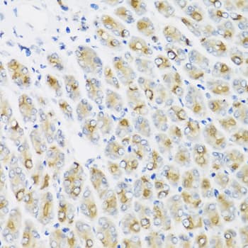 IFNL1 / IL29 Antibody