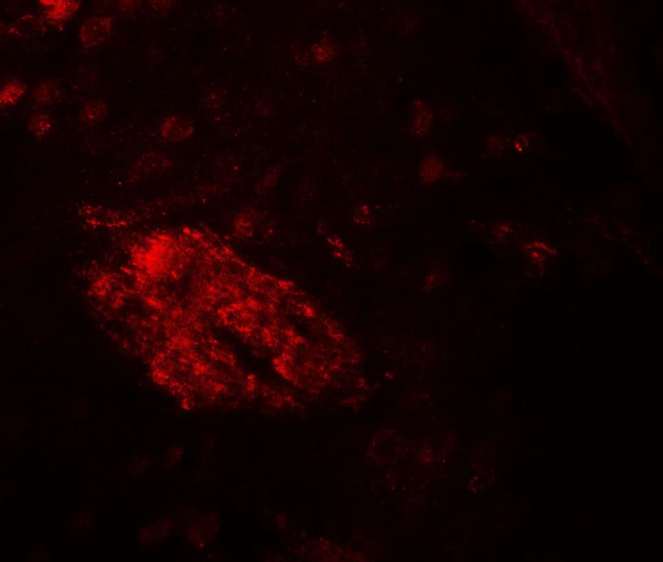 IHC-plus™ WDR61 Antibody
