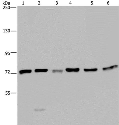 Polyclonal Rabbit anti-Human KARS Antibody (IHC, WB)