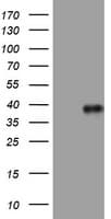 Monoclonal Mouse anti-Human PIK3C2A Antibody (clone OTI2D9, aa230-560, IHC, WB)