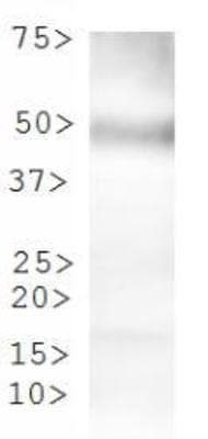 TPH2 Antibody