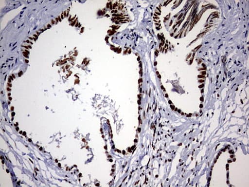 Monoclonal Mouse anti-Human HNRPM / HNRNPM Antibody (clone OTI1F6, aa1-261, IHC, WB)