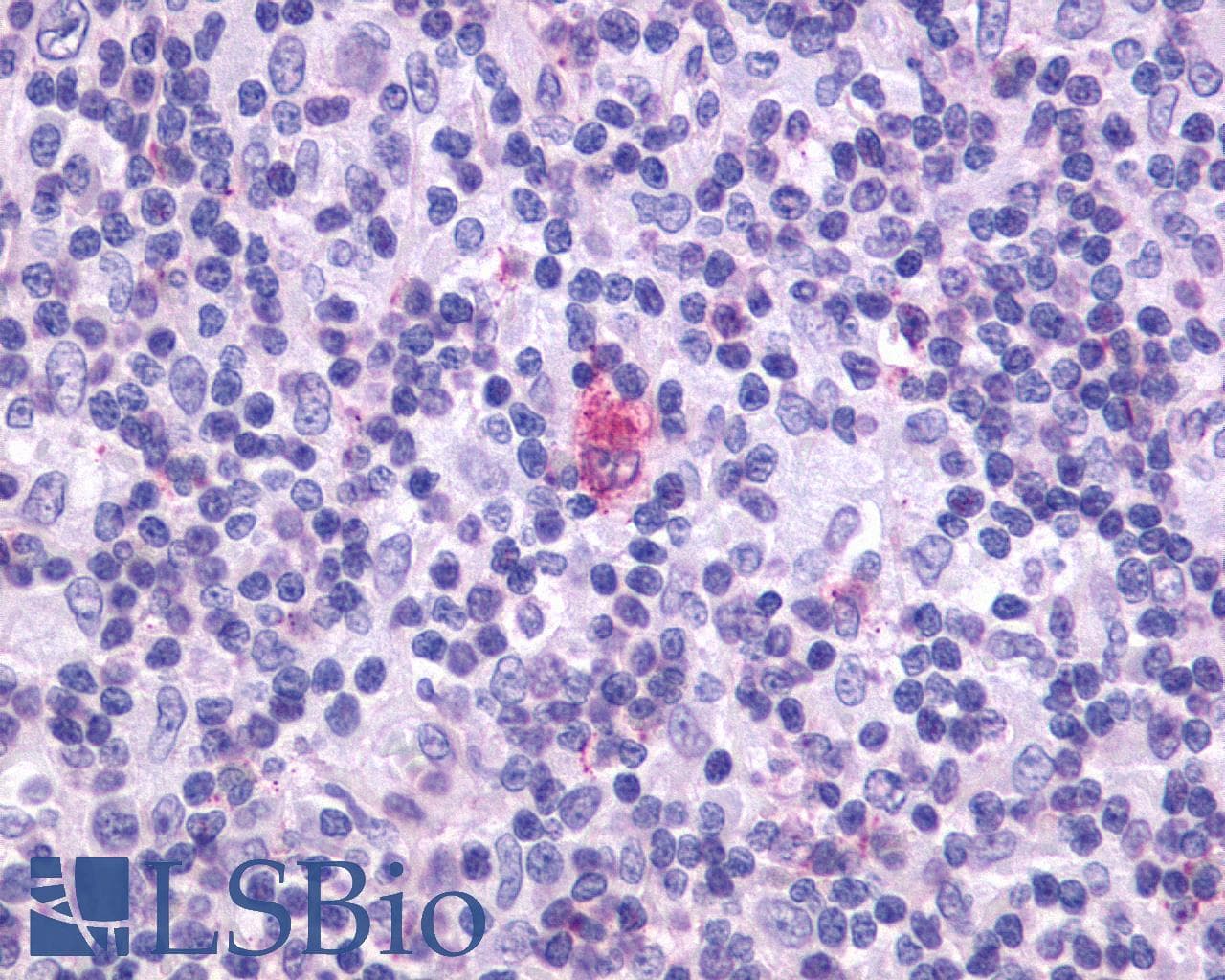 IHC-plus™ CXCR5 Antibody (Cytoplasmic Domain)