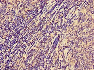 NCR1 / NKP46 Antibody