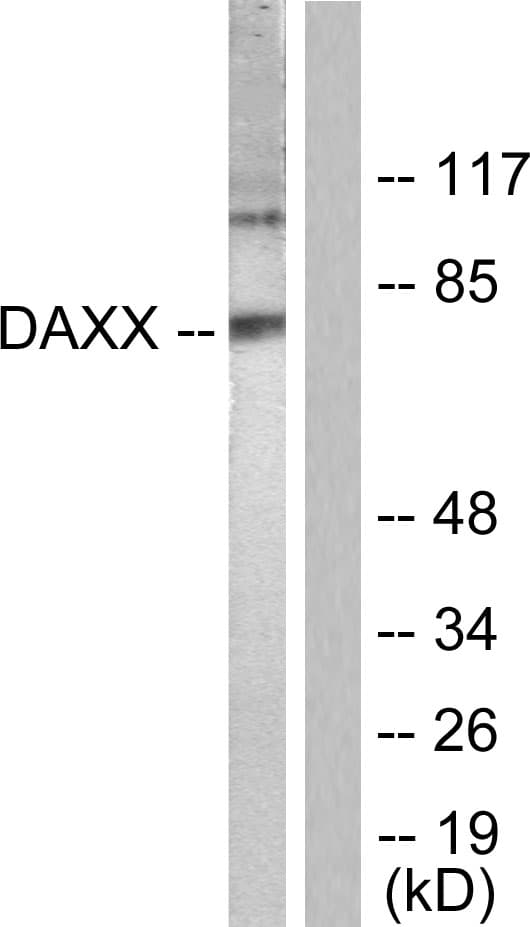IHC-plus™ DAXX Antibody (aa634-683)