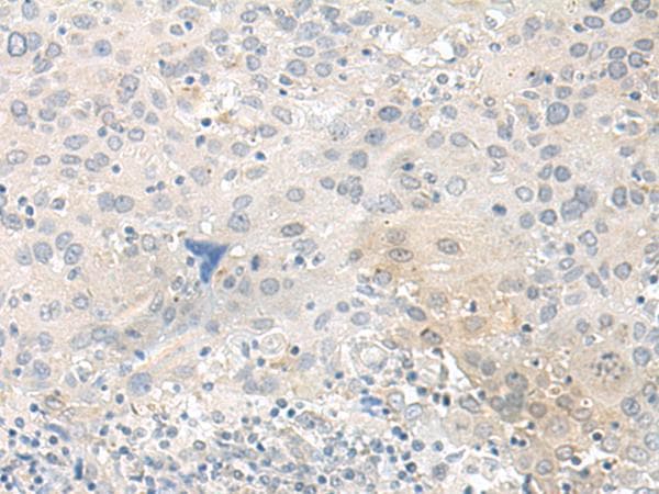 TUBG2 / Tubulin Gamma 2 Antibody