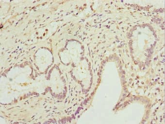 RAB5C Antibody