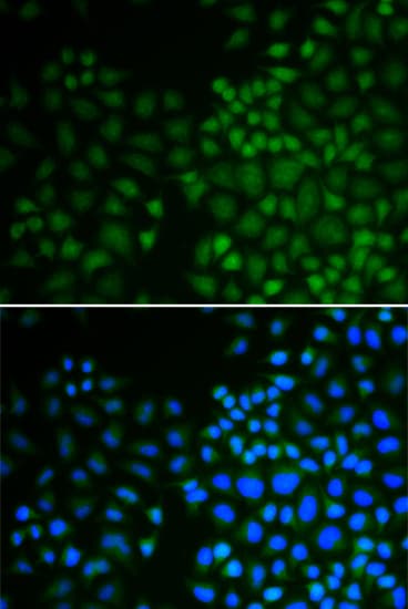 Polyclonal Rabbit anti-Human NR0B2 Antibody (IHC, IF, WB)