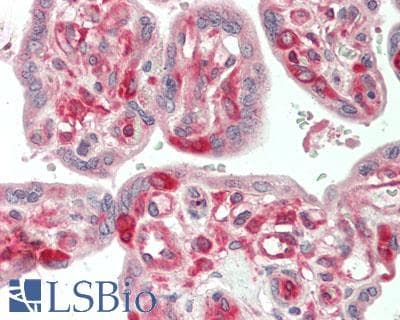 IHC-plus™ TRIP / LRRFIP1 Antibody