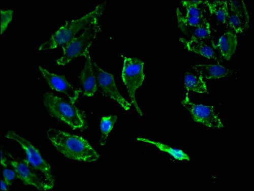 KIF14 Antibody