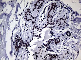 NBN / Nibrin Antibody (aa183-460, clone OTI3C12, Carrier-free)