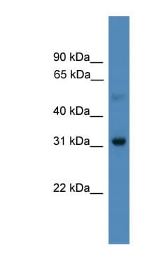 LBX1 Antibody (aa21-70)