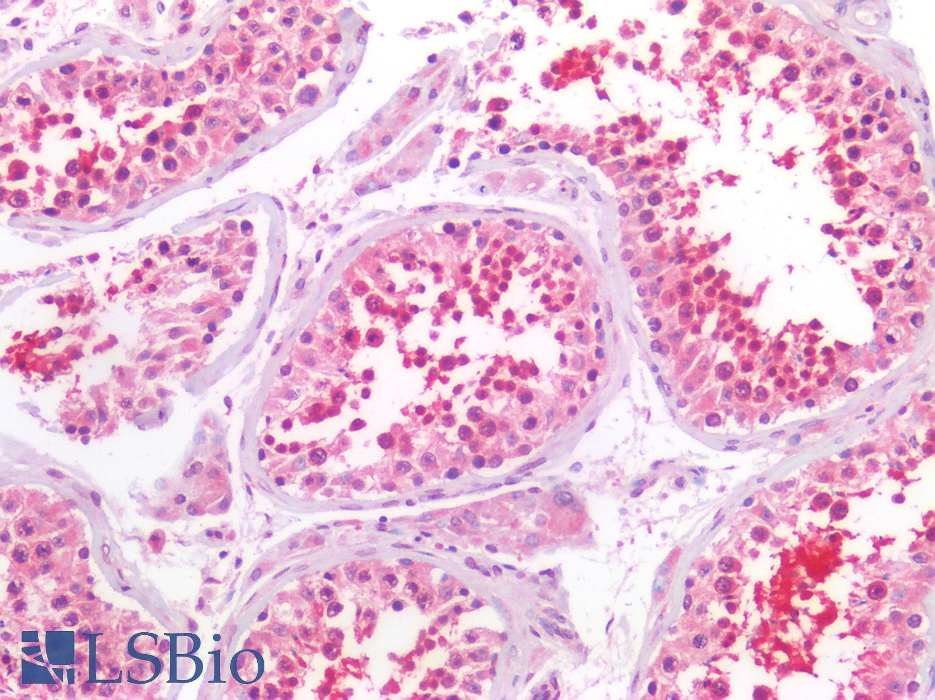 IHC-plus™ IPO5 / RANBP5 Antibody