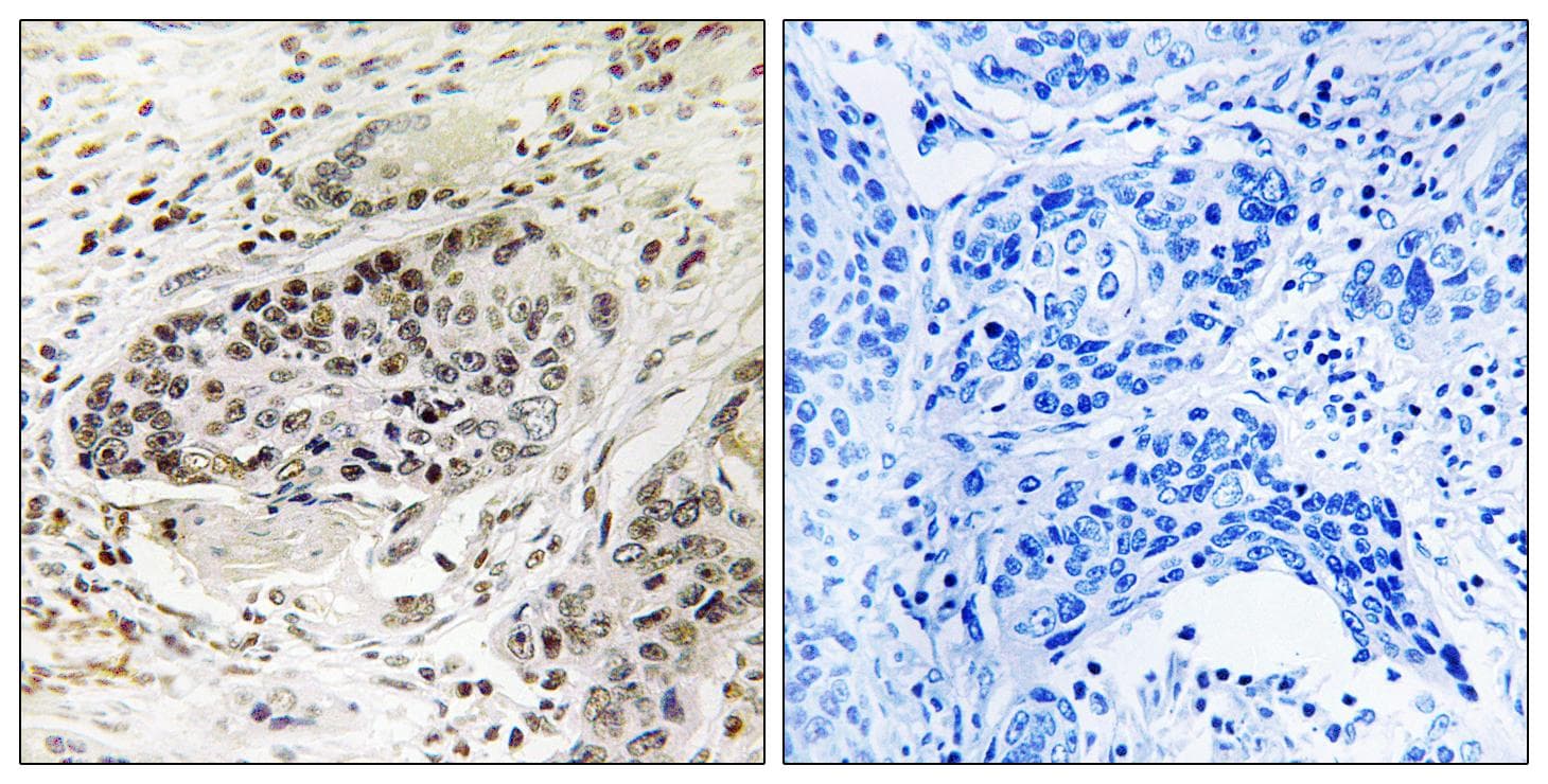 Polyclonal Rabbit anti-Human APBA2 Antibody (IHC)