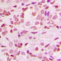NFKBIA / IKB Alpha / IKBA Antibody (N-Terminus)