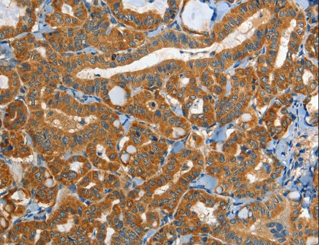 EPHB3 / EPH Receptor B3 Antibody