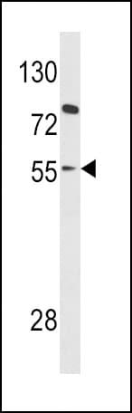 Polyclonal Rabbit anti-Human PAX8 Antibody (aa285-313, IHC, WB)