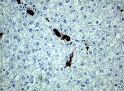 KRT19 / CK19 / Cytokeratin 19 Antibody (aa240-390, clone UMAB2)
