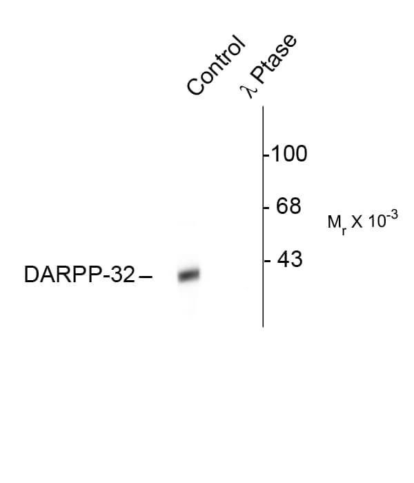 PPP1R1B / DARPP-32 Antibody (phospho-Thr34)