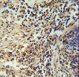 ZNF720 Antibody (aa34-62)