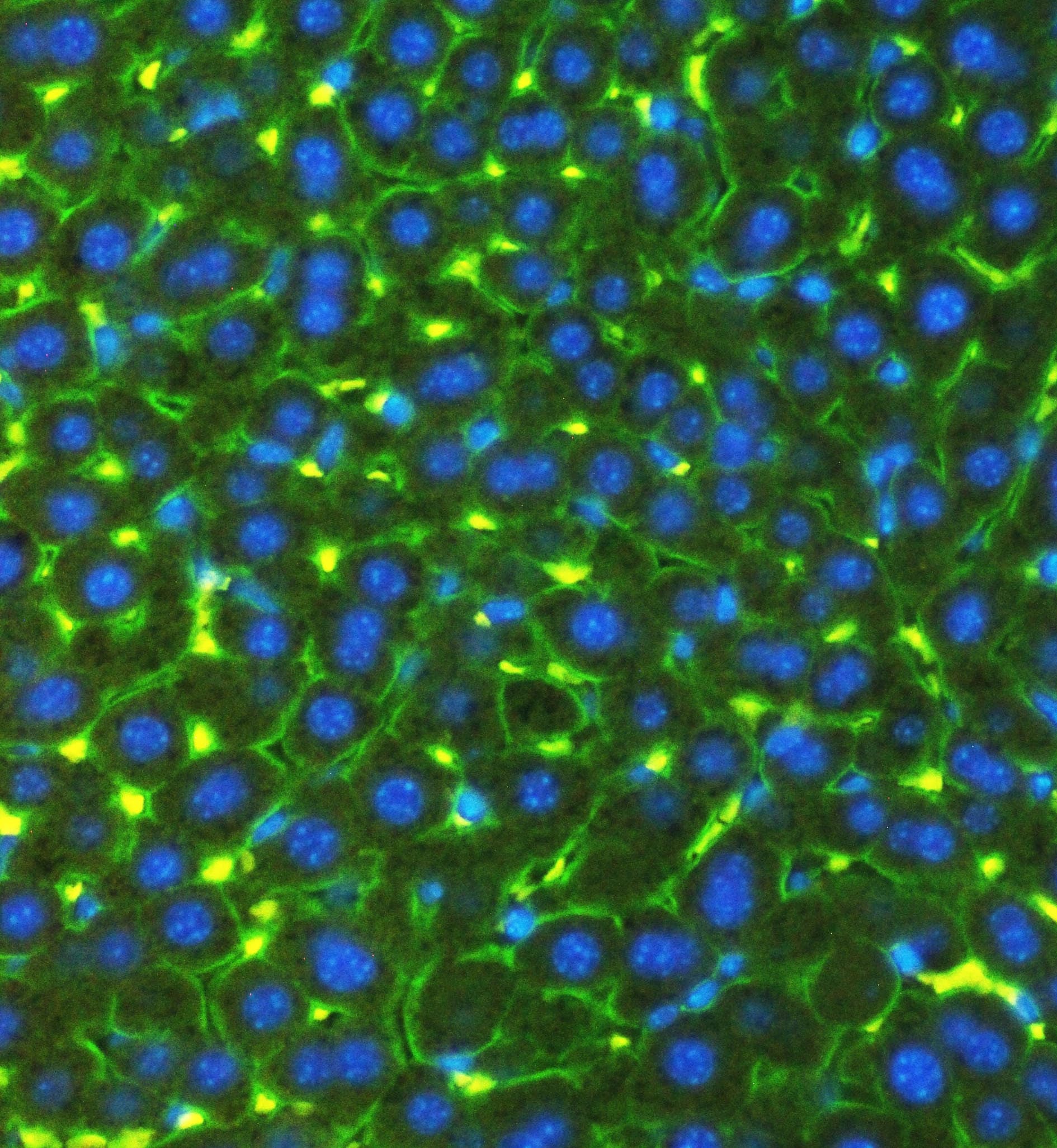 Polyclonal Rabbit anti-Mouse SLC10A1 / NTCP Antibody (aa296-336, IHC, WB)