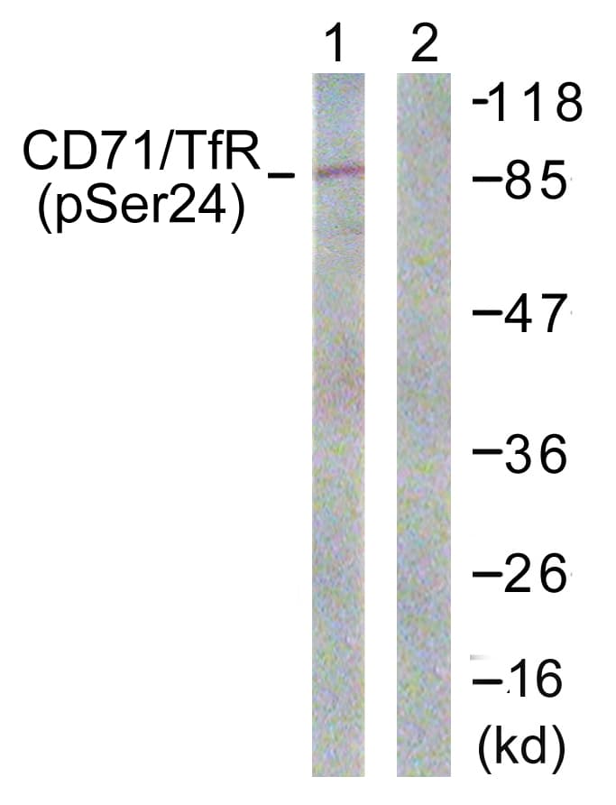 CD71 / Transferrin Receptor Antibody (phospho-Ser24)