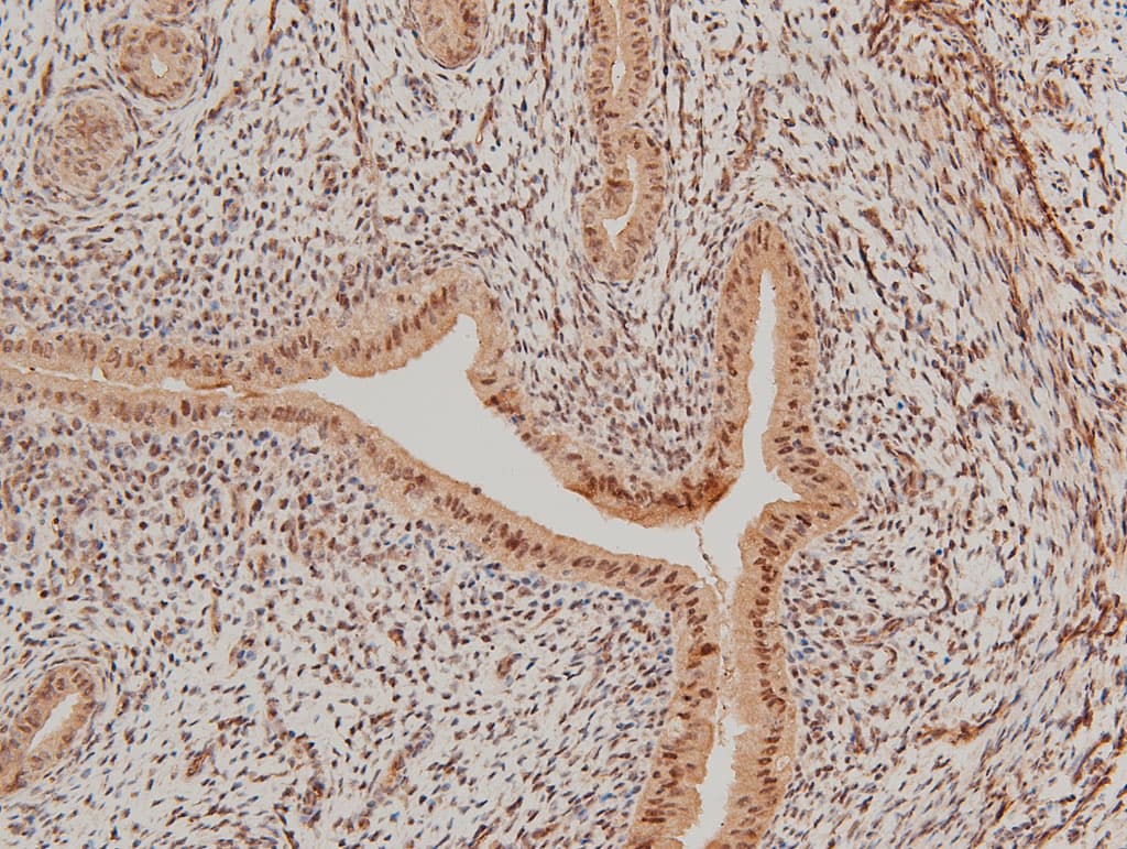 LIMK1 / LIMK Antibody (phospho-Thr508)