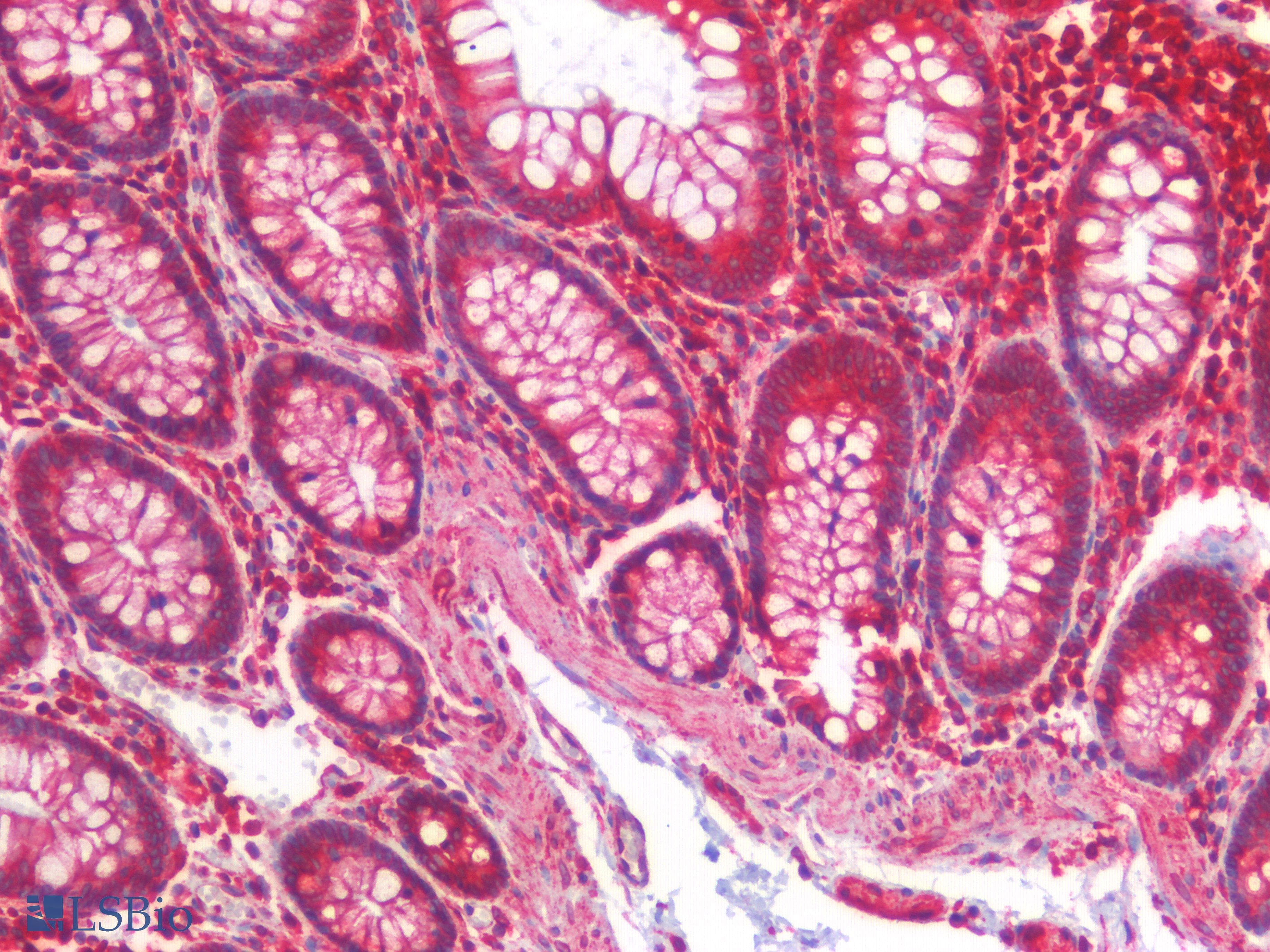PathPlus™ CANX / Calnexin Antibody