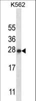 IL22 Antibody (aa44-73)