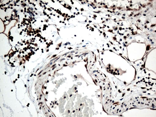 RCOR1 / COREST Antibody (aa256-485, clone OTI9F6, Carrier-free)