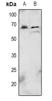 AKT1 Antibody